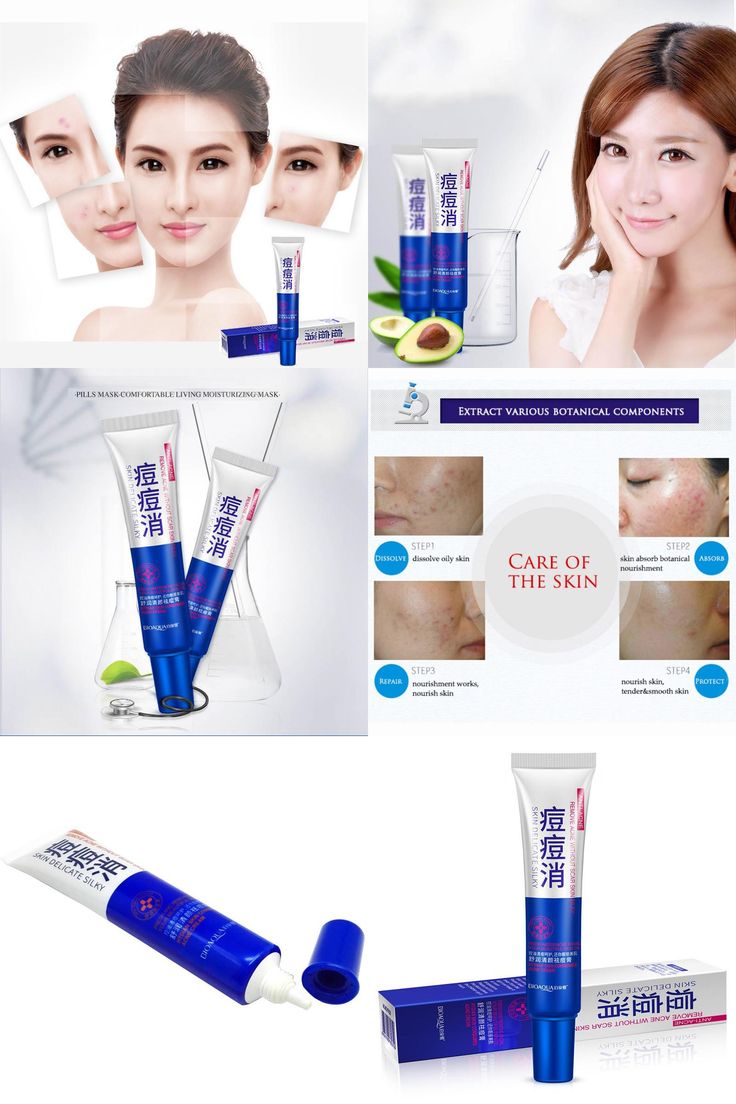 کرم تیوپی درمانی ضد جوش و آکنه اورژانسی